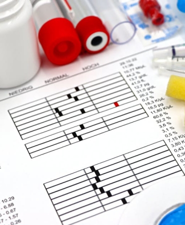 Usta Oyuncu Arif Ertan Guntav Kalp Krizi Sonucu Vefat Etti featured